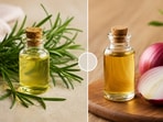 Rosemary oil or onion oil, what to prefer