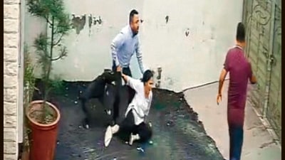Woman suffers multiple injuries, undergoes surgery; cops begin FIR process. (HT) Woman suffers multiple injuries, undergoes surgery; cops begin FIR process. (HT)