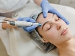 Here's what you need to know before going for Botox treatment.