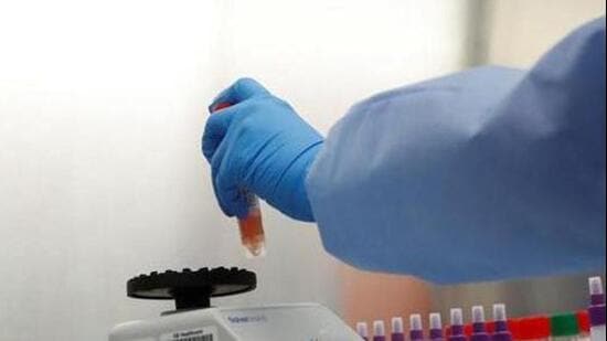 Including ₹1.98 crore in GST and ₹21,930 towards material testing, the total project cost is estimated at ₹13.05 crore. (REPRESENTATIVE PHOTO)