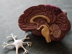 Vascular health issues, including high blood pressure and diabetes, increase dementia risk.
