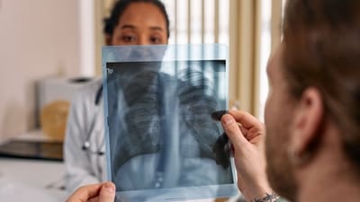 Early symptoms of lung cancer are often subtle. (Pexel) Early symptoms of lung cancer are often subtle. (Pexel)