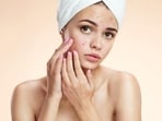 Sensitive skin may even see sudden rise of pimples. 