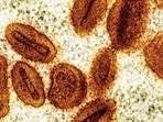 The disease, which was first detected in humans in 1970 in the Democratic Republic of Congo, causes fever, muscular aches and large boil-like skin lesions, and can be deadly.