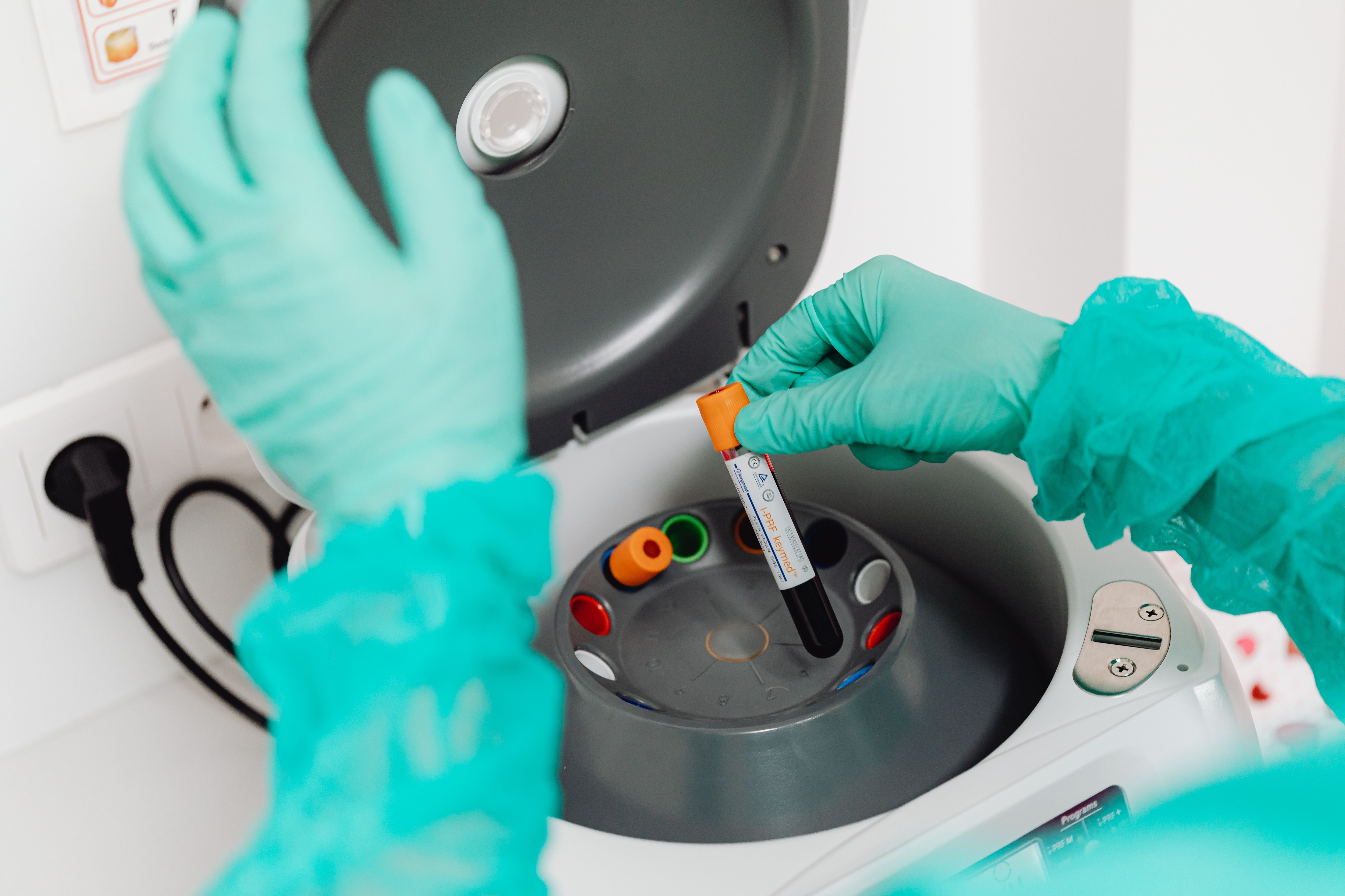 Blood tests show what is happening biochemically but do not always reveal the underlying lifestyle factors. (Pexel) Blood tests show what is happening biochemically but do not always reveal the underlying lifestyle factors. (Pexel)