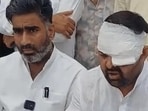 SP MLA Atul Pradhan with Digvijay Bhati (bandaged eye) during a press conference in Meerut on Friday (Sourced)