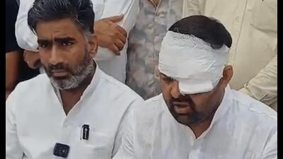 SP MLA Atul Pradhan with Digvijay Bhati (bandaged eye) during a press conference in Meerut on Friday (Sourced) SP MLA Atul Pradhan with Digvijay Bhati (bandaged eye) during a press conference in Meerut on Friday (Sourced)