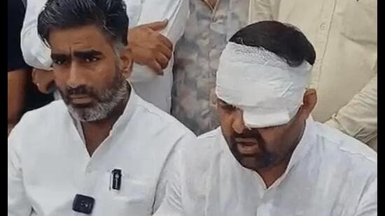 SP MLA Atul Pradhan with Digvijay Bhati (bandaged eye) during a press conference in Meerut on Friday (Sourced)
