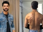 Karan Wahi recalls the impact of the Pellet Gun Stunt in Khatron Ke Khiladi 15.