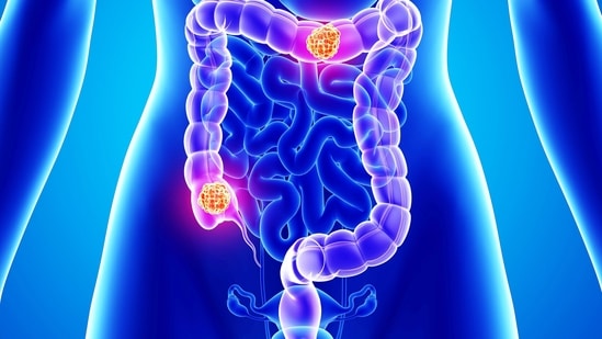 According to Dr Tanvi, ZFP36L2 is part of an emergency repair program in our bodies.