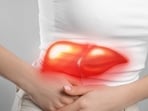 Fatty liver disease is increasing exponentially as people are leading sedentary lifestyles. 