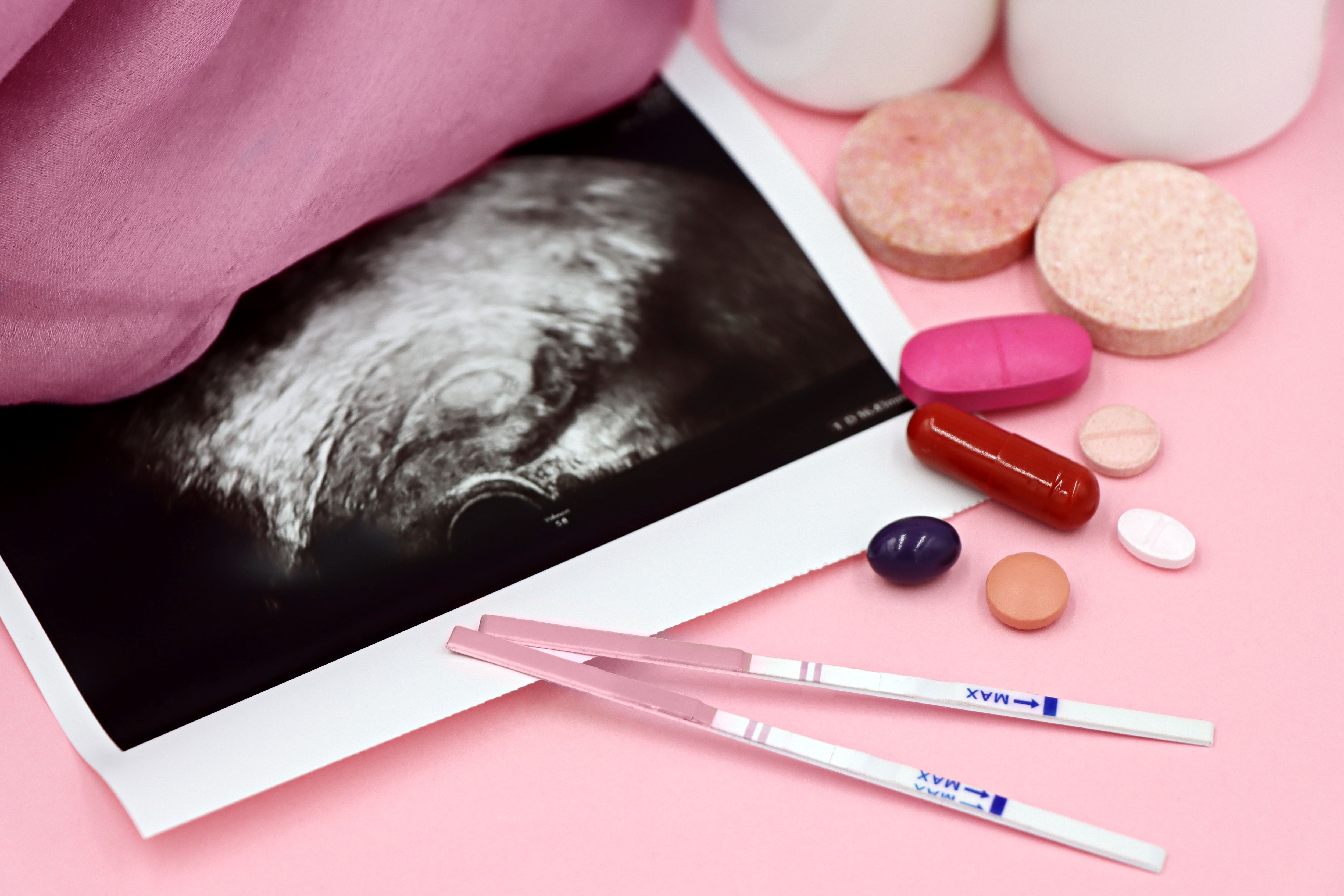 The sperm sample used for IUI is processed before insemination to concentrate sperm that are suitable for the procedure. (Unsplash)