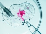 IVF(Shutterstock)