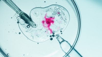 IVF (Shutterstock) IVF (Shutterstock)