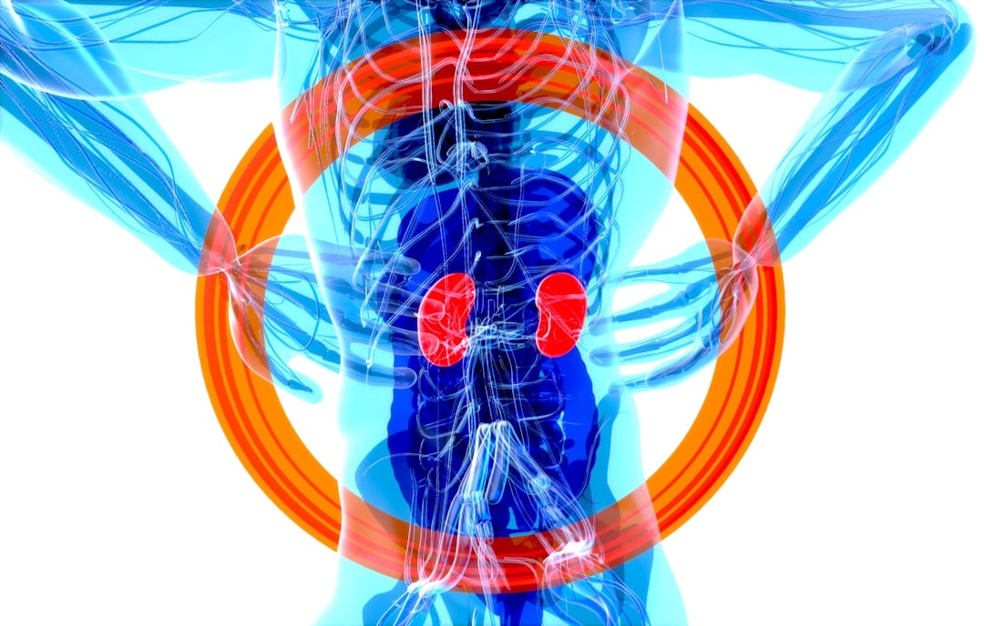 The kidney stones may have different sizes, and whereas smaller stones will be excreted easily. (Unsplash)