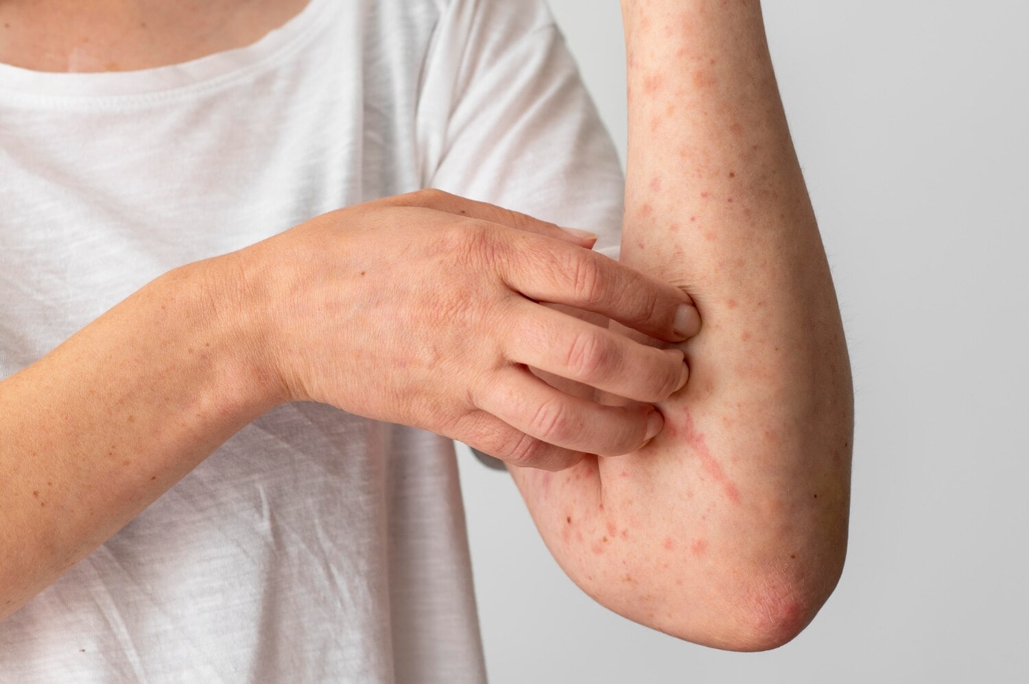 Children’s rashes can stem from viral infections, allergies, eczema, insect bites or skin infections. (Picture credit: Freepik) Children’s rashes can stem from viral infections, allergies, eczema, insect bites or skin infections. (Picture credit: Freepik)