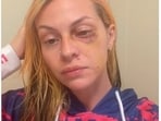 Pamalla Rodriguez launched a GoFundMe campaign for medical and legal expenses after allegedly being assaulted by rapper Famous Dex. 
