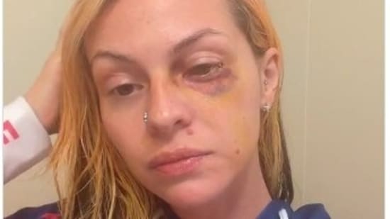 Pamalla Rodriguez launched a GoFundMe campaign for medical and legal expenses after allegedly being assaulted by rapper Famous Dex.