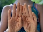 Your fingers turn wrinkly after a long bath for a surprising reason. Scientists say it’s not simply because your skin absorbs water.