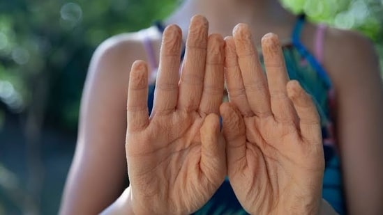 Your fingers turn wrinkly after a long bath for a surprising reason. Scientists say it’s not simply because your skin absorbs water.