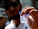 Sahil Lochab, who suffered pellet gun injuries during the previous month's protests, shows pellets that he says were removed from his body, outside a police station.