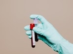 As you age, you may become more vulnerable to certain conditions and health issues, making age-appropriate tests and screenings essential.