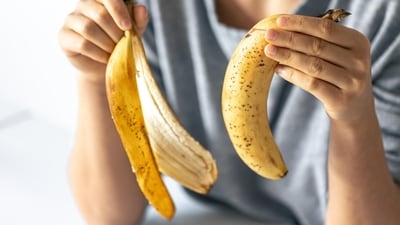 A social media beauty hack claims banana peels are 'nature's Botox' that can smooth wrinkles. (Freepik) A social media beauty hack claims banana peels are 'nature's Botox' that can smooth wrinkles. (Freepik)