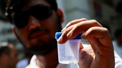 Sahil Lochab, who suffered pellet gun injuries during the previous month's protests, shows pellets that he says were removed from his body, outside a police station. (REUTERS)