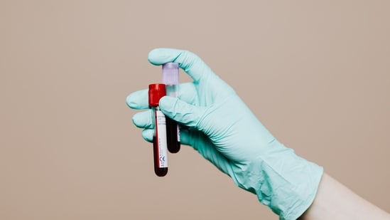 As you age, you may become more vulnerable to certain conditions and health issues, making age-appropriate tests and screenings essential.