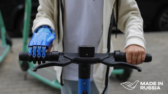 Teenage user of the CYBI Fingers body-powered hand prosthesis