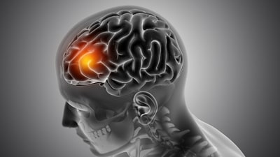Strokes can also happen in young adults. (Picture credit: Freepik) Strokes can also happen in young adults. (Picture credit: Freepik)
