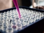 Scientifically called oocyte cryopreservation, the process involves hormonal stimulation of the ovaries, usually for 10 to 14 days, followed by egg retrieval. 