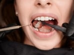 Oral Health (Freepik)