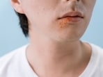 Dermatologist shares lip care tips for men who always skip balm.
