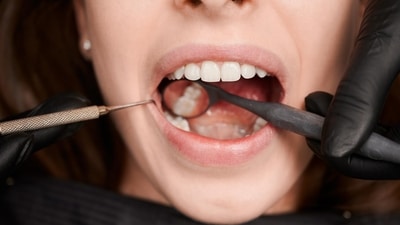 Oral Health (Freepik) Oral Health (Freepik)