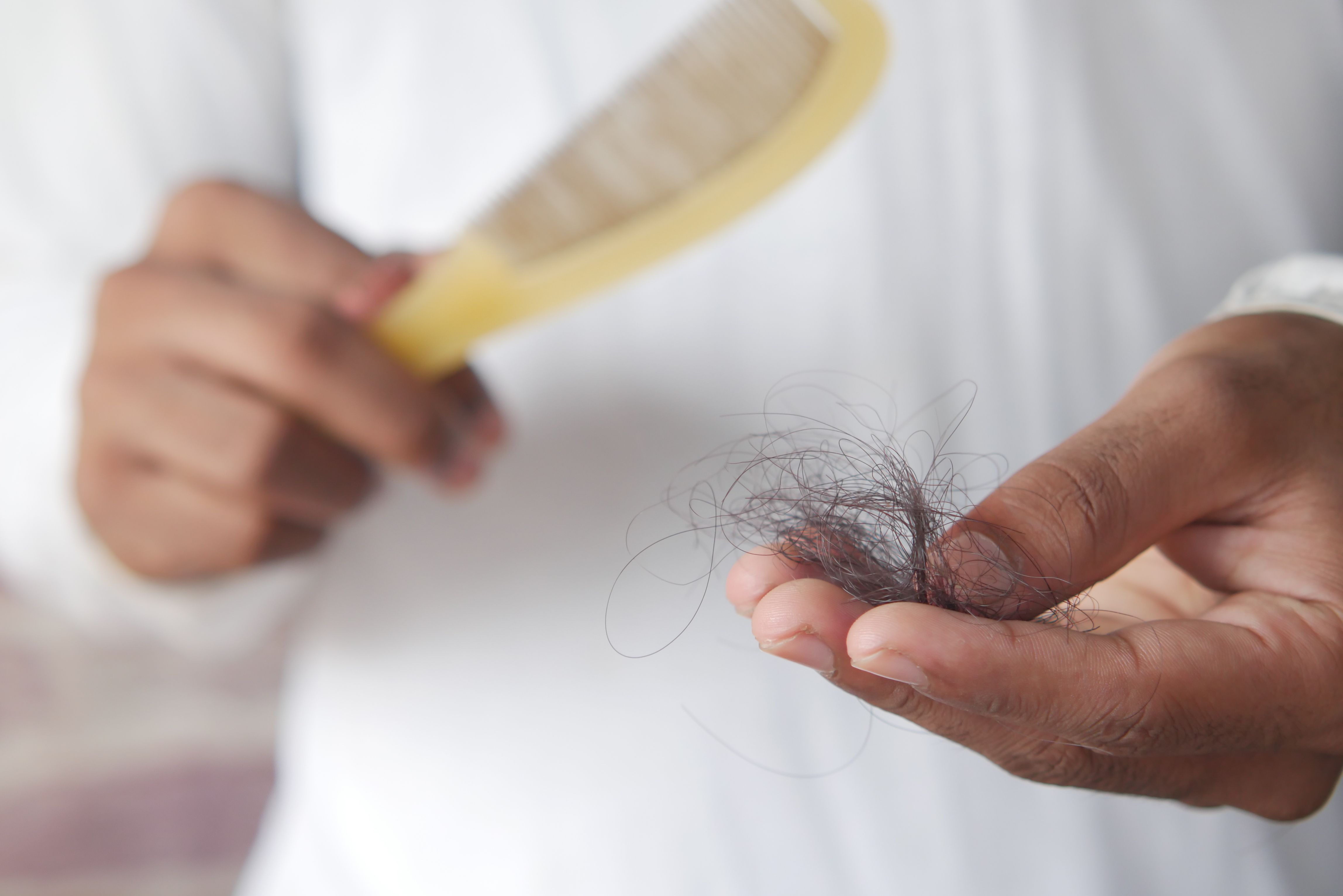 Stressed and shedding a lot of hair? A doctor explains why it happens and how to bounce back. (Pexels) Stressed and shedding a lot of hair? A doctor explains why it happens and how to bounce back. (Pexels)