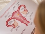 PCOS doesn’t mean you can’t get pregnant. 