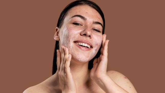 7 face washes for acne and summer breakouts