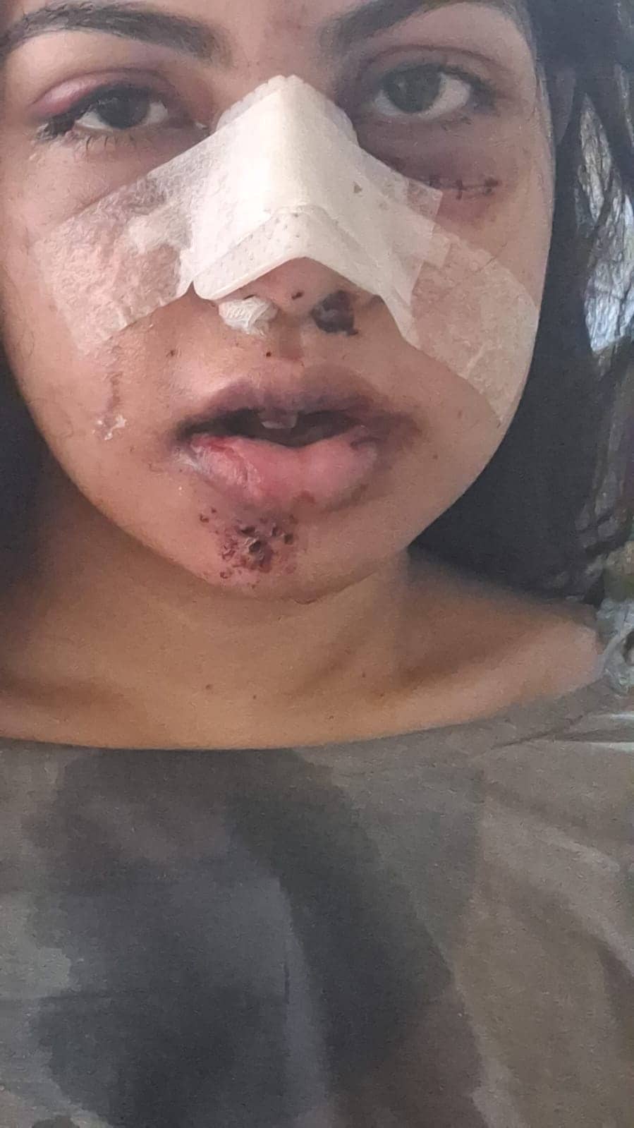 The 23-year-old was returning from Ambamata Temple on August 27 when the dilapidated iron gate at Sachinam Heights fell on her. (HT Photo/Sourced) The 23-year-old was returning from Ambamata Temple on August 27 when the dilapidated iron gate at Sachinam Heights fell on her. (HT Photo/Sourced)