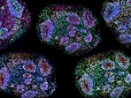 Supreme Court had previously ruled that stem cell therapy for autism cannot be offered as a routine clinical service or commercial treatment.
