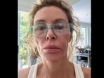 Brandi Glanville GoFundMe: RHOBH alum breaks down as Real Housewives stars donate for her treatment(GoFundMe)