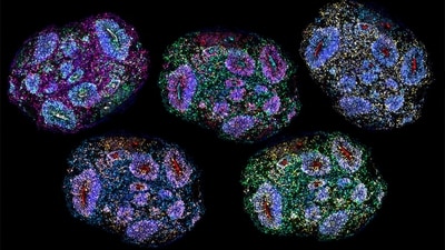 Supreme Court had previously ruled that stem cell therapy for autism cannot be offered as a routine clinical service or commercial treatment. (AFP/Representational)
