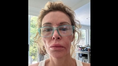 Brandi Glanville GoFundMe: RHOBH alum breaks down as Real Housewives stars donate for her treatment (GoFundMe) Brandi Glanville GoFundMe: RHOBH alum breaks down as Real Housewives stars donate for her treatment (GoFundMe)
