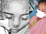 భార్య ముక్కు కొరికిన భర్త