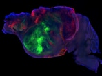 This side view of a lab mouse brain shows nerve fibres extending from a human graft through the mouse brain, coloured with green and red fluorescent proteins, while the mouse brain is coloured blue.