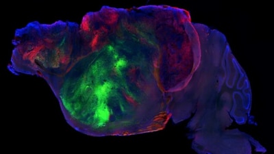 This side view of a lab mouse brain shows nerve fibres extending from a human graft through the mouse brain, coloured with green and red fluorescent proteins, while the mouse brain is coloured blue. (S. Pașca lab/Stanford University) This side view of a lab mouse brain shows nerve fibres extending from a human graft through the mouse brain, coloured with green and red fluorescent proteins, while the mouse brain is coloured blue. (S. Pașca lab/Stanford University)