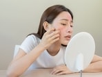 Purging often shows up in redness and acne. 