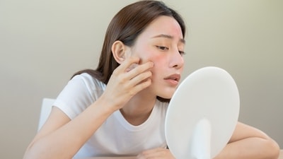 Purging often shows up in redness and acne. (Picture credit: Shutterstock) Purging often shows up in redness and acne. (Picture credit: Shutterstock)