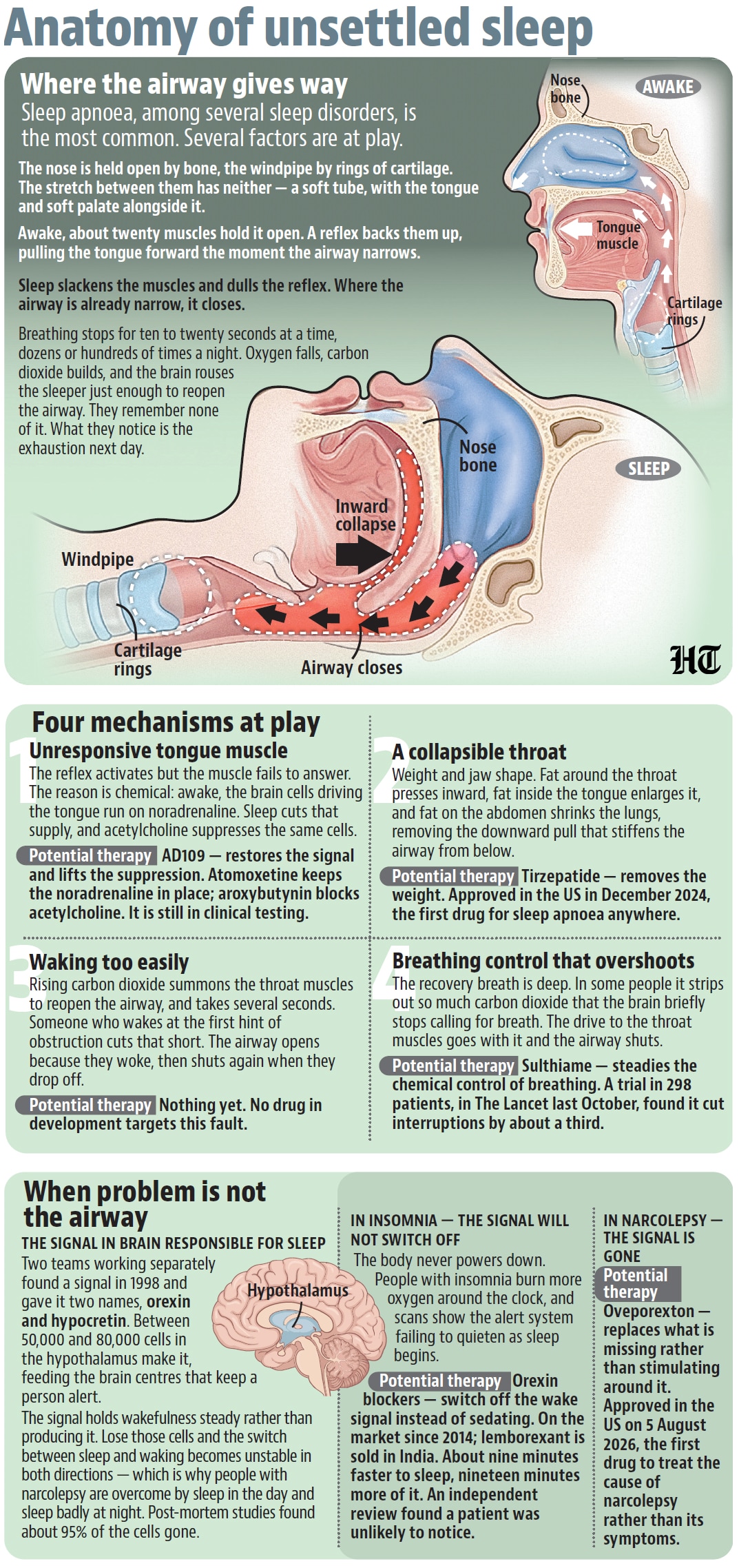 HT graphic HT graphic
