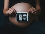 Are X-rays safe for pregnant women? Read more to find out!(Unsplash)